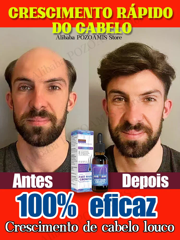 Recupere Seus Cabelos – Diga Adeus à Calvície com Nosso Produto de Sucesso!